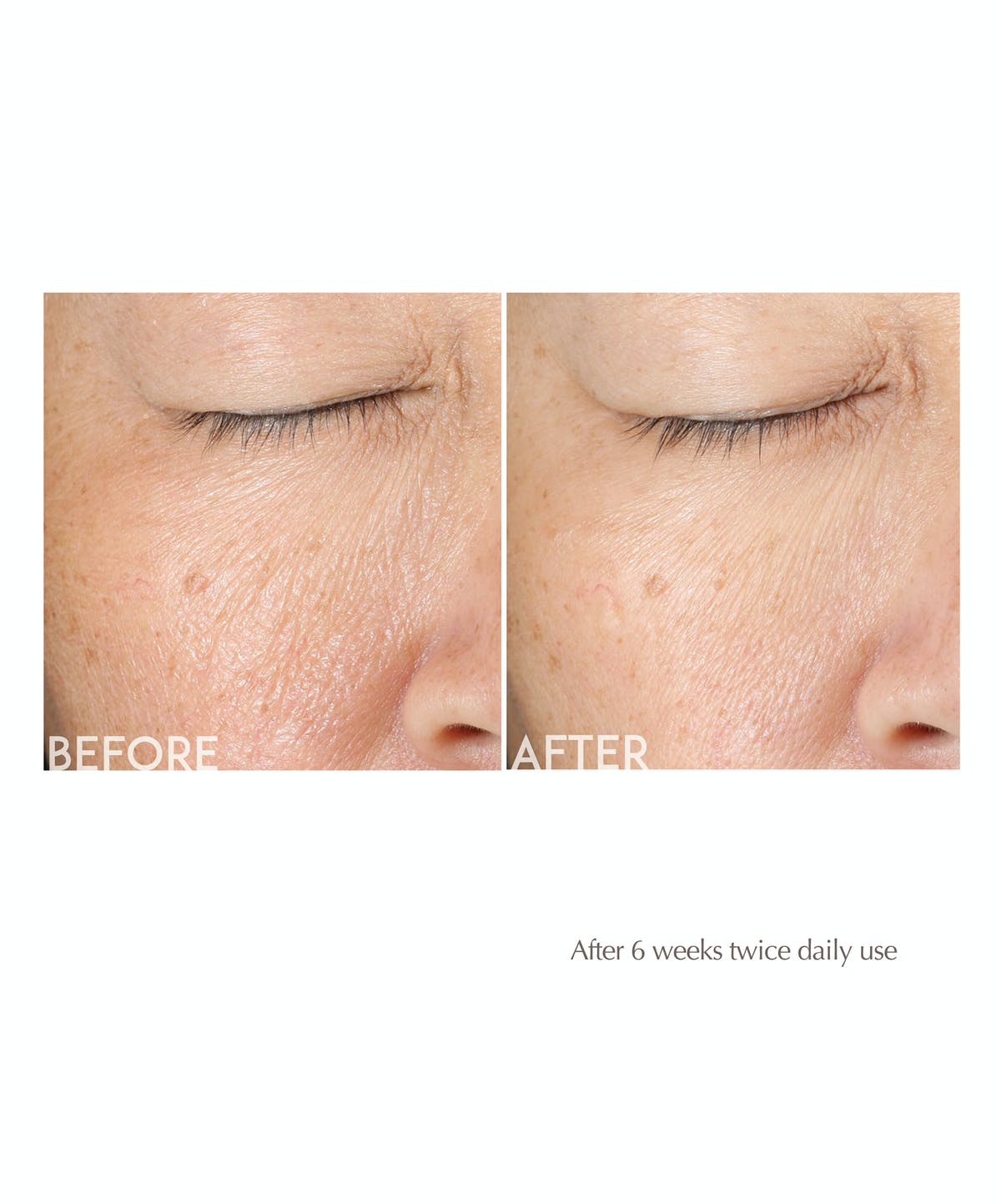 Obagi-C Rx Exfoliating Day Lotion