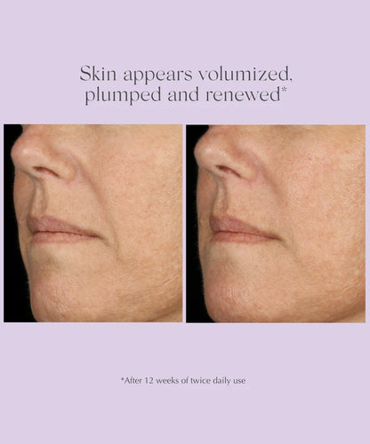 AGE REVERSE+ Total Correct Serum